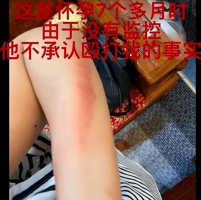 2022年“自毁前途”的10位艺人，花样作死，没有一个值得原谅