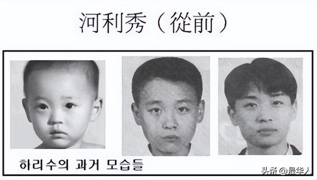 最美变性人河莉秀：被丈夫抛弃，后遗症明显，身体不如80岁老太太