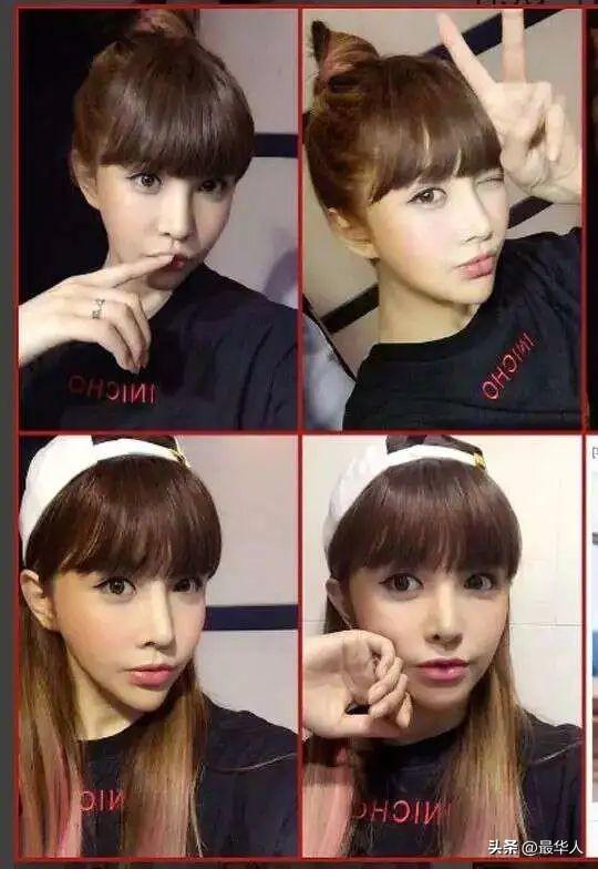 最美变性人河莉秀：被丈夫抛弃，后遗症明显，身体不如80岁老太太