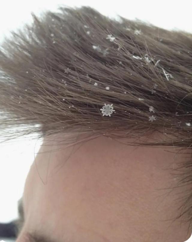 显微镜下的雪花–感受大自然馈赠的美