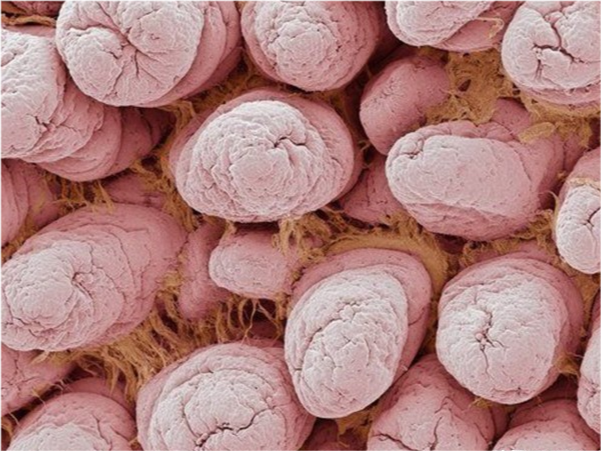 31张显微镜下拍摄的图片，看完感觉世界观被完全颠覆了