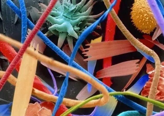 31张显微镜下拍摄的图片，看完感觉世界观被完全颠覆了