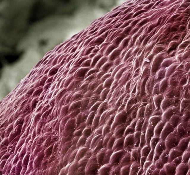 31张显微镜下拍摄的图片，看完感觉世界观被完全颠覆了