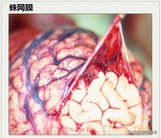 神经解剖（27图）解剖知识必备