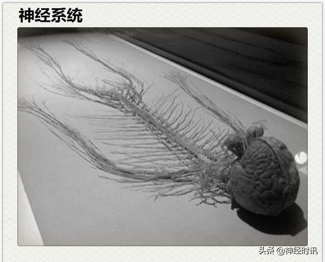 神经解剖（27图）解剖知识必备