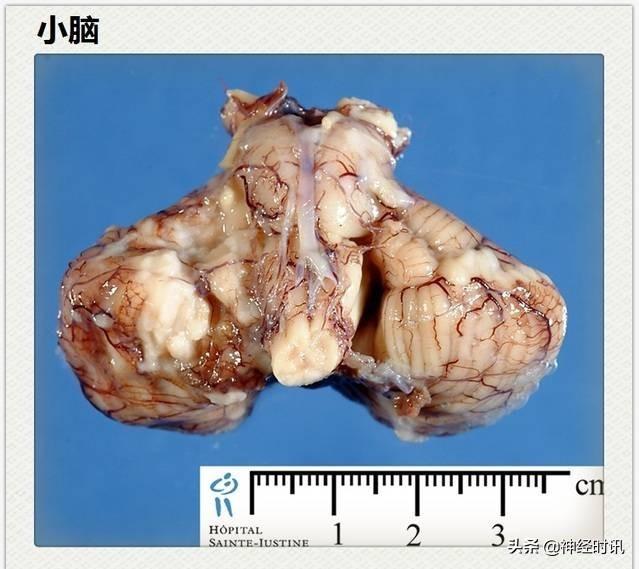 神经解剖（27图）解剖知识必备