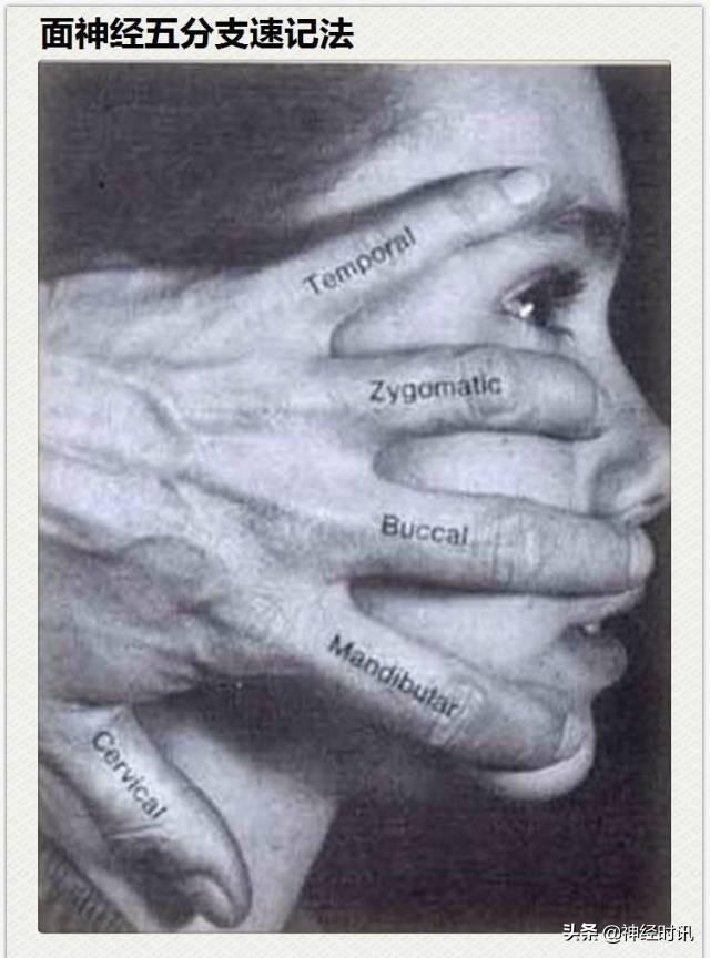 神经解剖（27图）解剖知识必备
