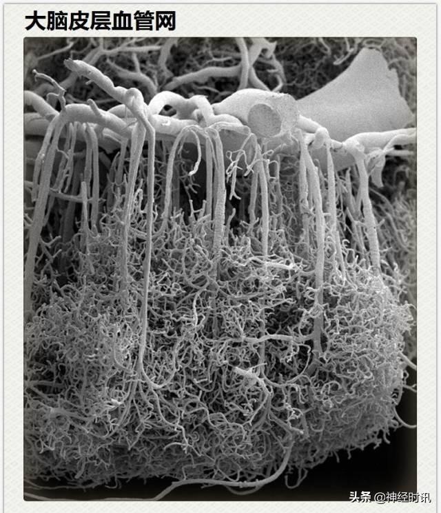 神经解剖（27图）解剖知识必备