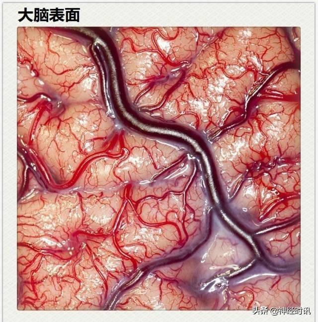 神经解剖（27图）解剖知识必备