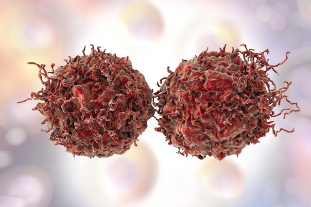 永生的海拉：拥有不死细胞的女人，繁衍细胞质量等同10座帝国大厦