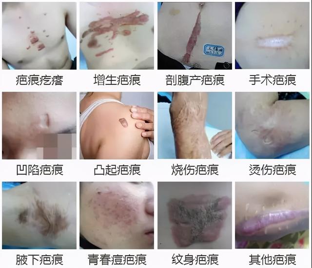 被科学家切成279块的神秘生物，拥有超强再生能力，是有多神奇？