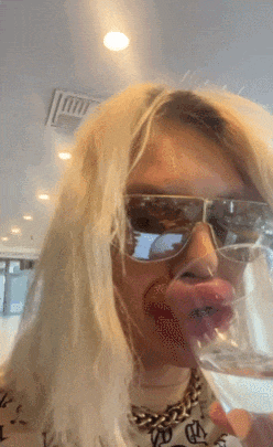 妹子丰唇27次，香肠嘴已经不足以形容了！疯狂到一天打6针