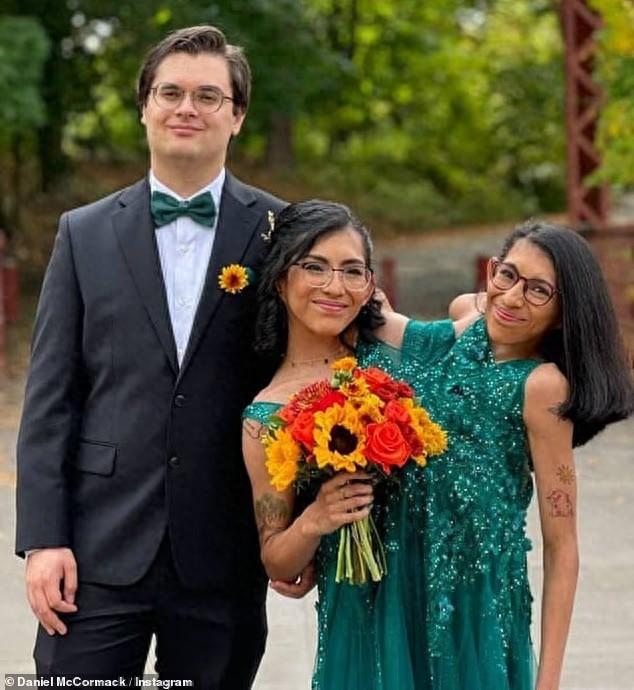 美国连体姐妹一个坚决不嫁，另一个刚结婚，未来永远三人相伴