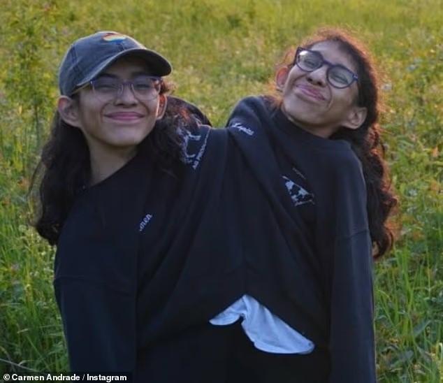 美国连体姐妹一个坚决不嫁，另一个刚结婚，未来永远三人相伴