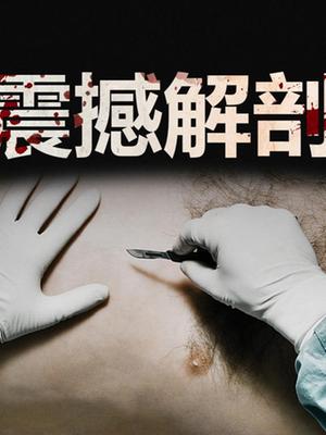 《震撼解剖》这部全是神反转奇案的解剖纪录片，堪称法医入坑神作